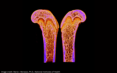 Scientists Discover a New Hormone that Can Build Strong Bones